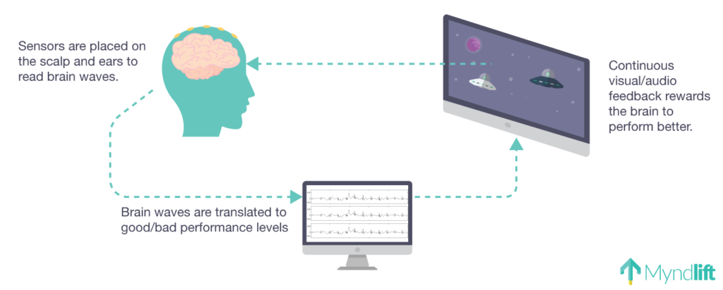 Neurofeedback Sex Addiction And Marriage Counseling Bull City